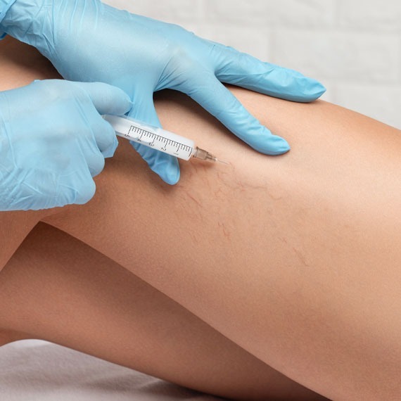 Vein Clinic & Med Spa